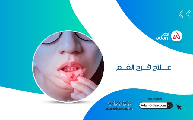 Mouth ulcers treatment