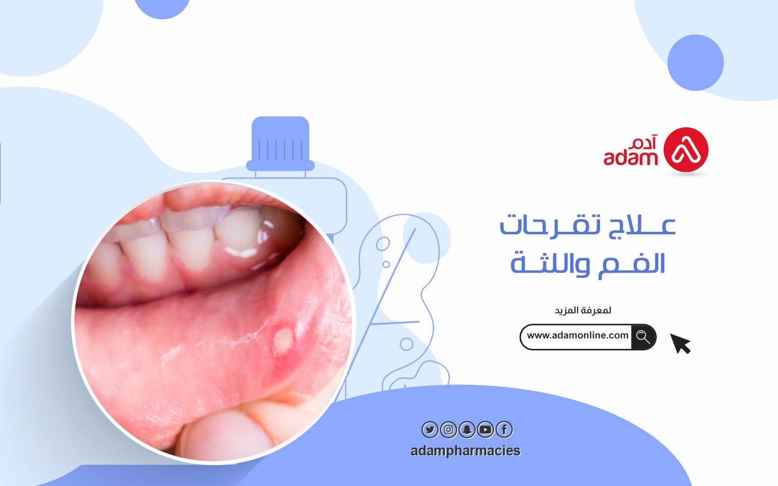 Mouth and gum ulcers treatment